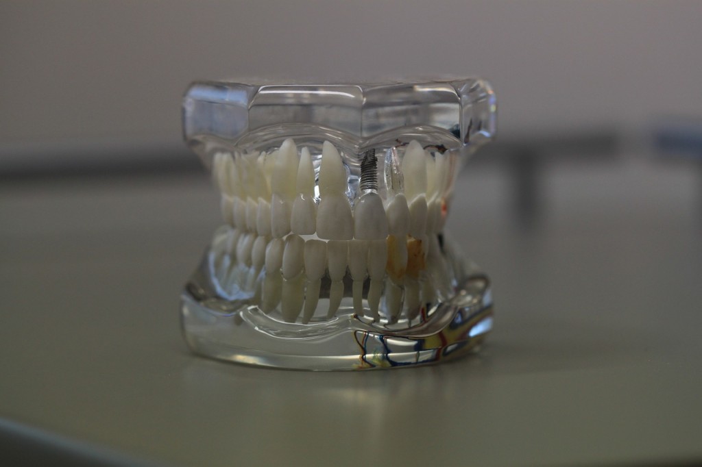 artificial teeth